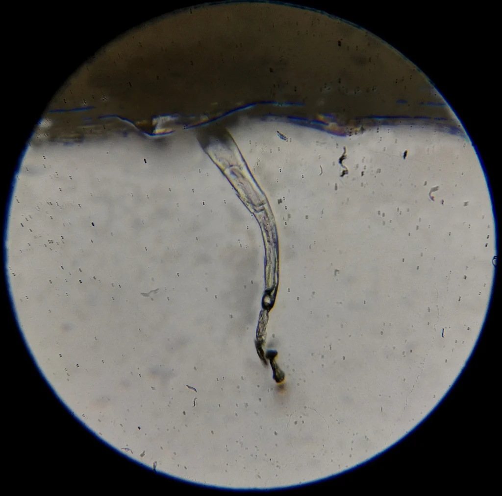 small root hair high mag 1